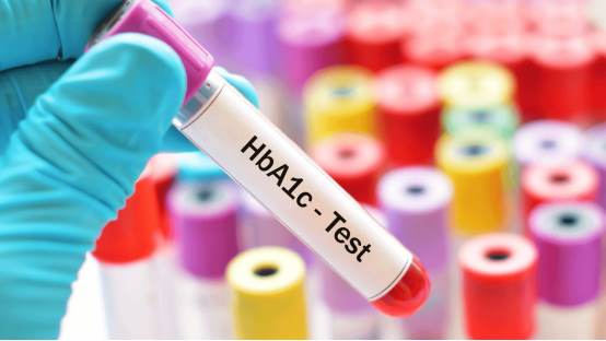 ग्लाइकेटेड हीमोग्लोबिन (HbA1c) टेस्ट क्या है?