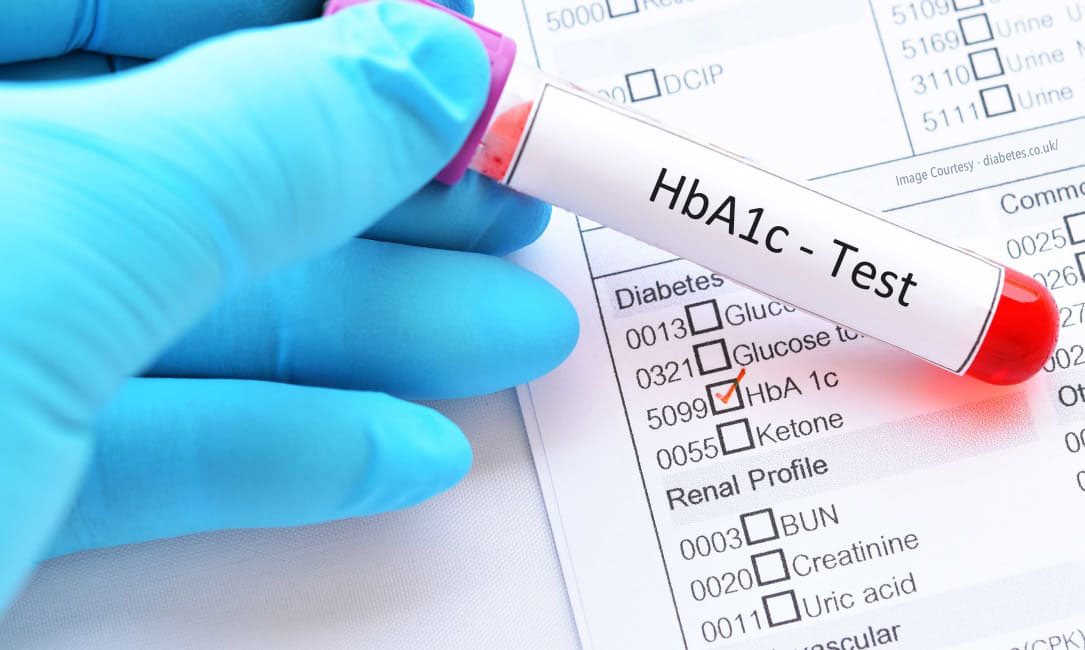 विभिन्न आबादी के लिए HbA1c परीक्षण